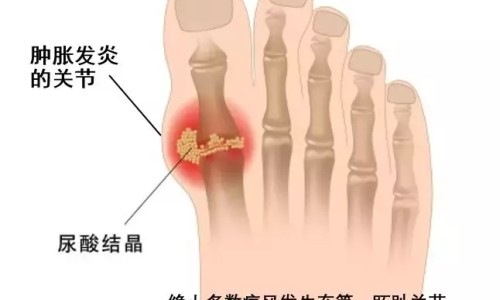 成人增高真的可以增高吗-成人增高所需营养网-分享一般成人增高需要多少费用多少，成人增高最快方法知识库